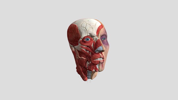 RTA Injury Écorché 3D Model