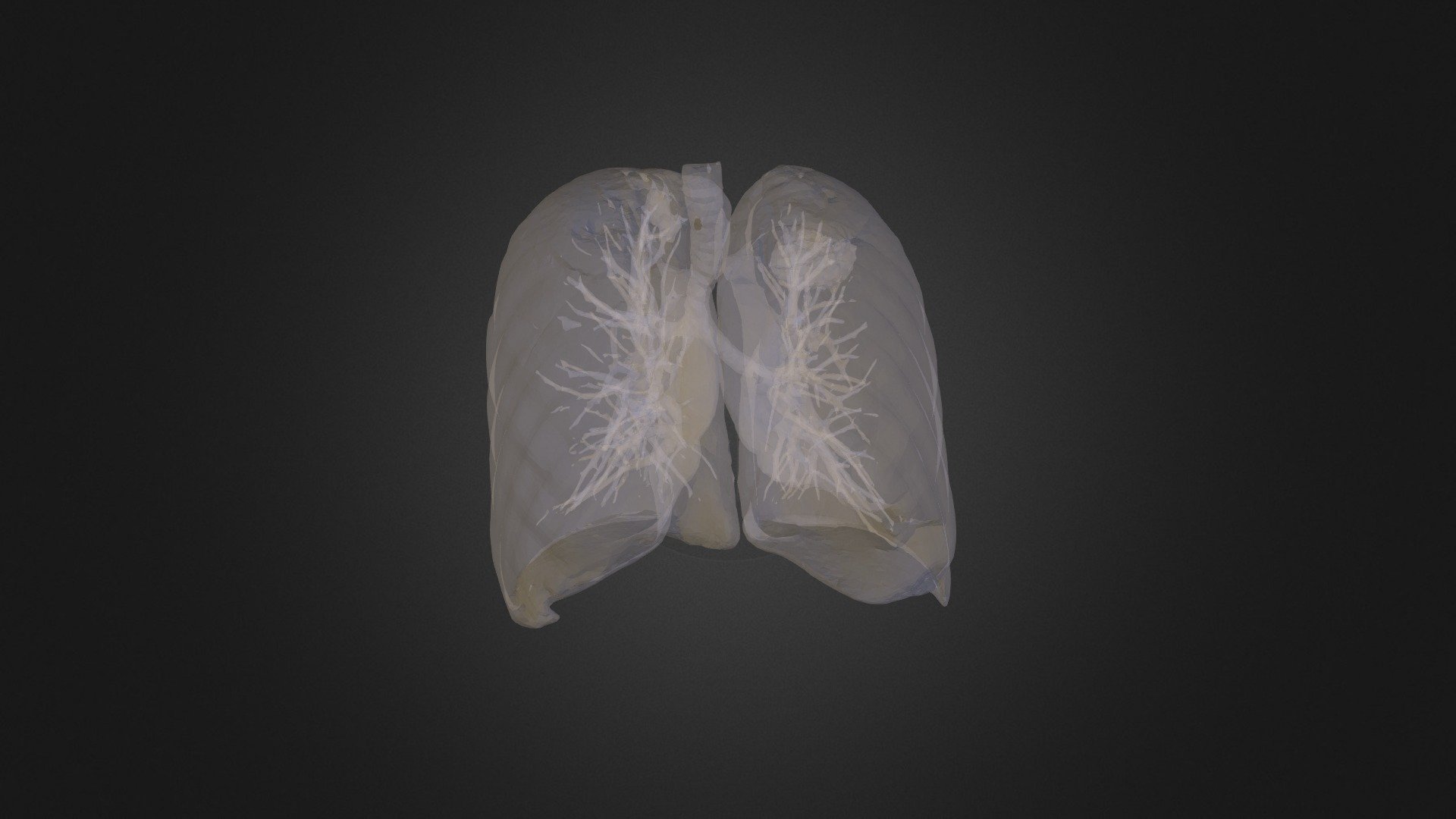 Lung Tumour