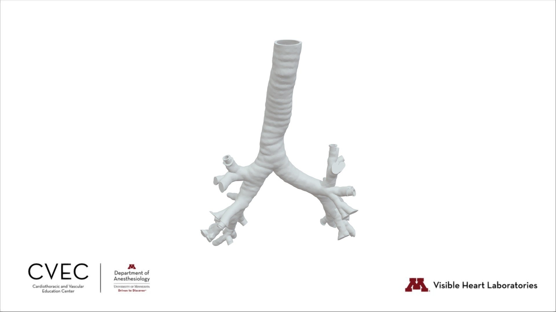 Tracheobronchial tree Download Free 3D model by CVEC [d3cbd7d