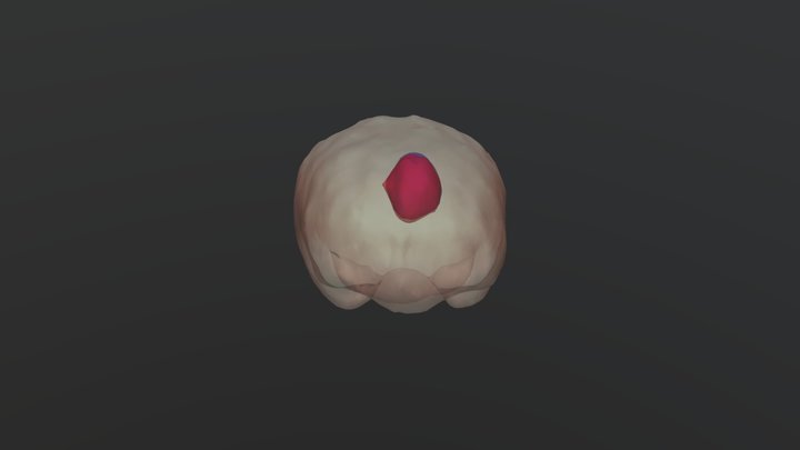 Brain Tumor Segmentation 3D Model