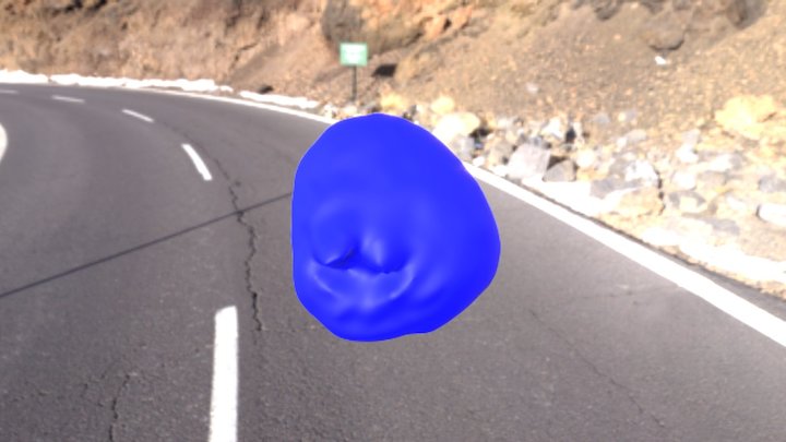 Aneurysm 2 3D Model