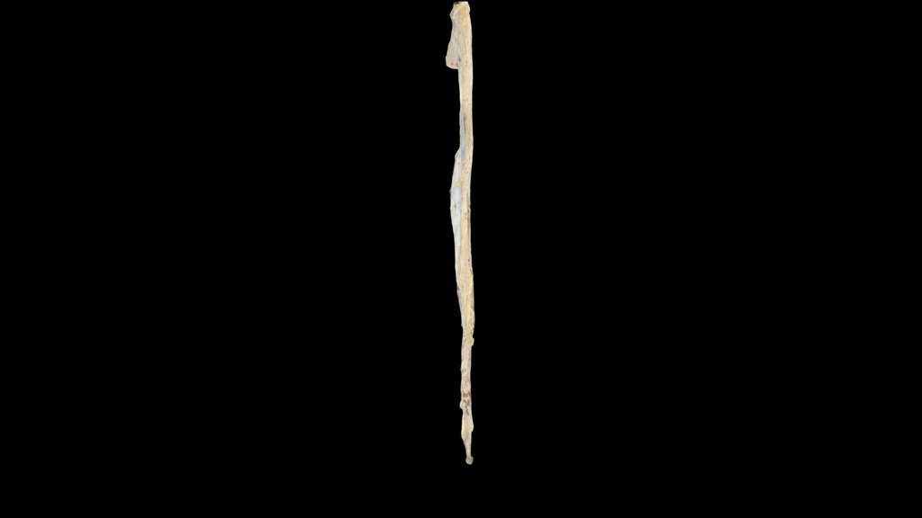MEDULA ESPINAL