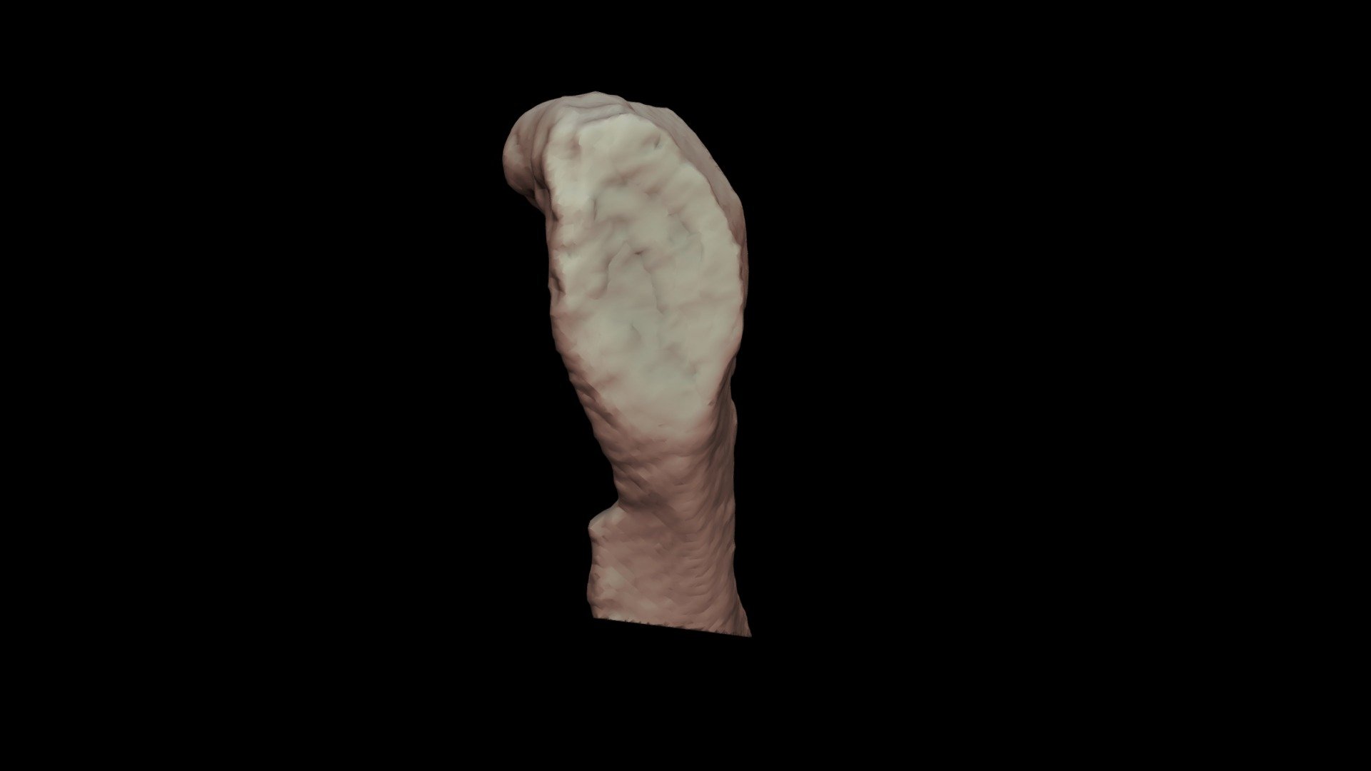 Pubic Symphysis Male 60yo