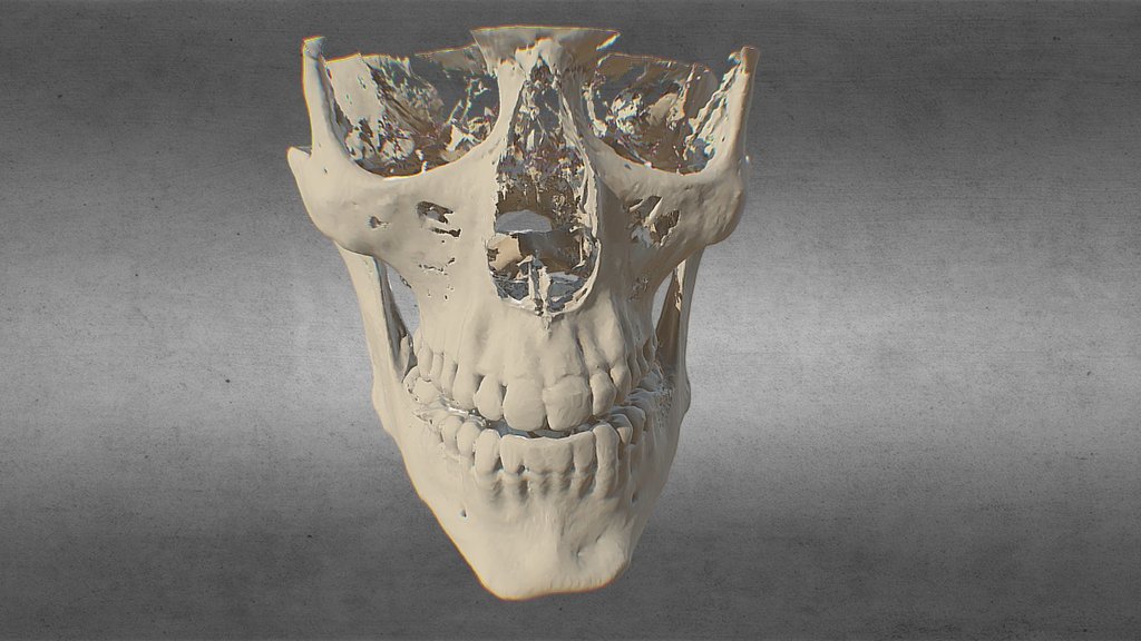 Dental Cone Beam CT