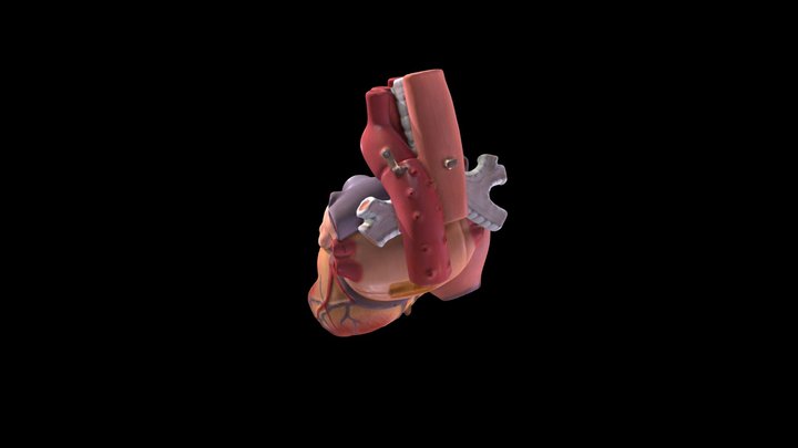 Heart (Plastic model) - Right ventricle 3D Model