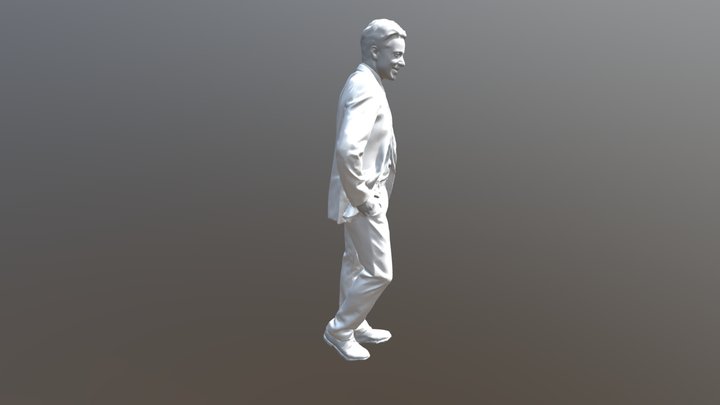 Triệu Chứng & Nguyên Nhân Gây Bệnh Nang Thận 3D Model