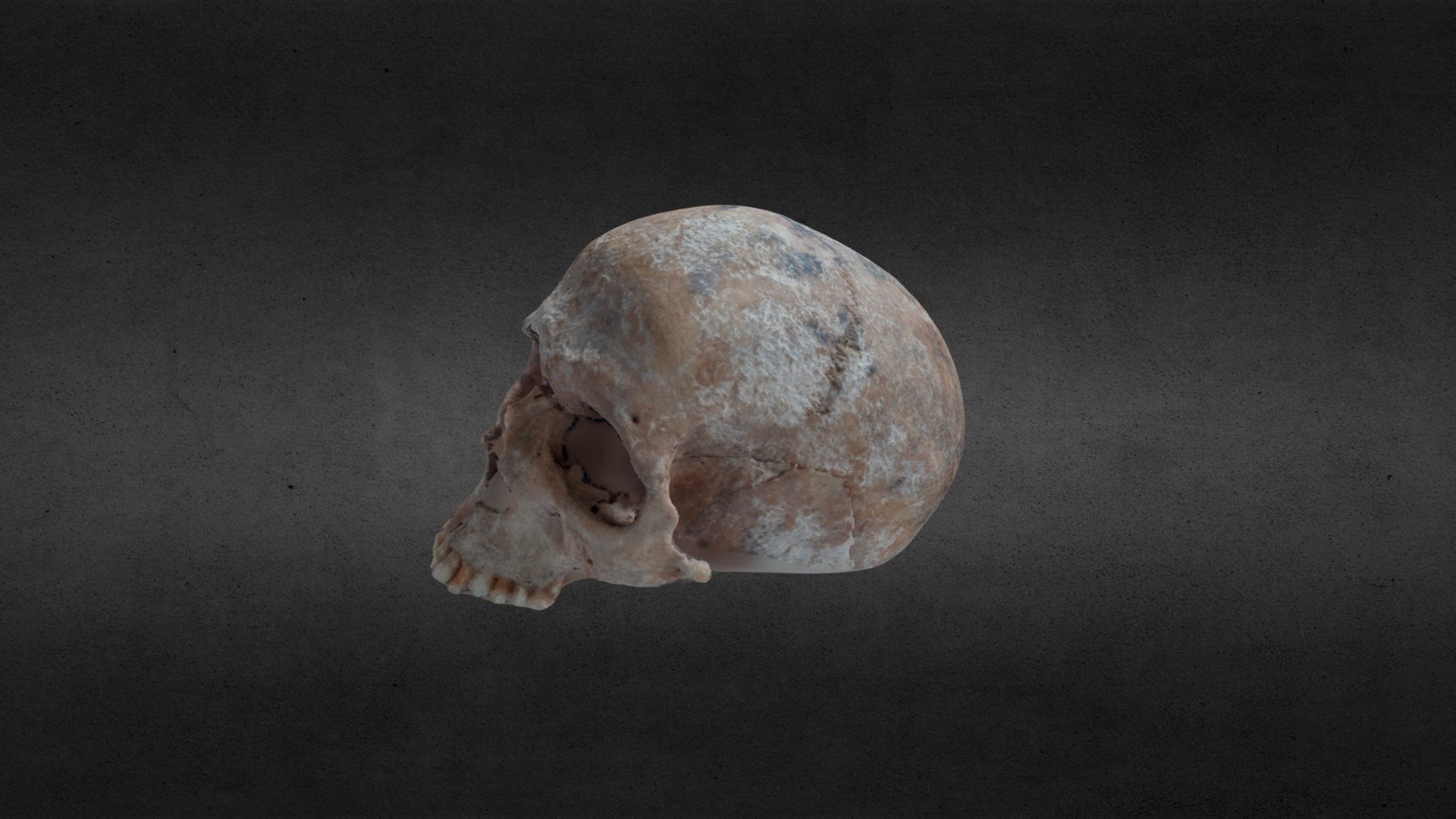 Skull