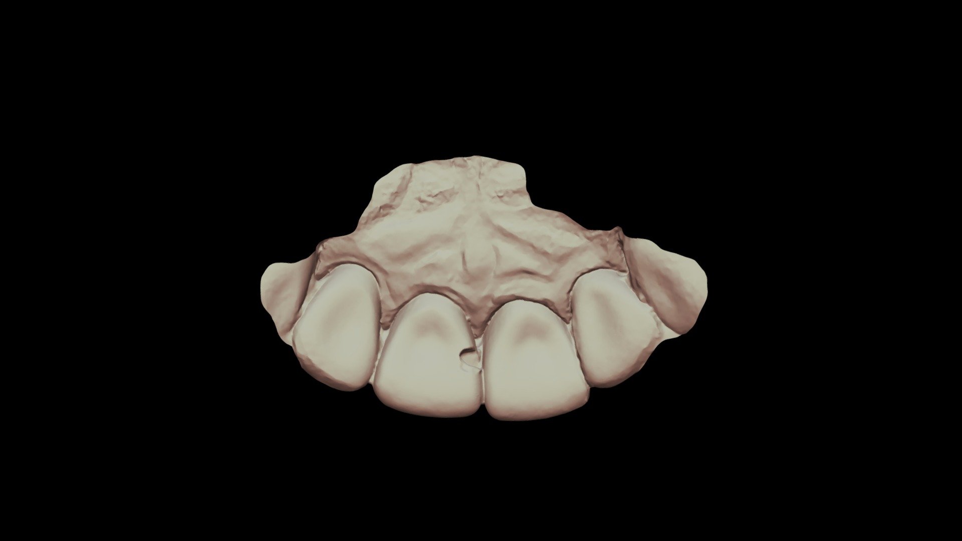 #9, Class3, Group8, Scanner6 Upper Jaw
