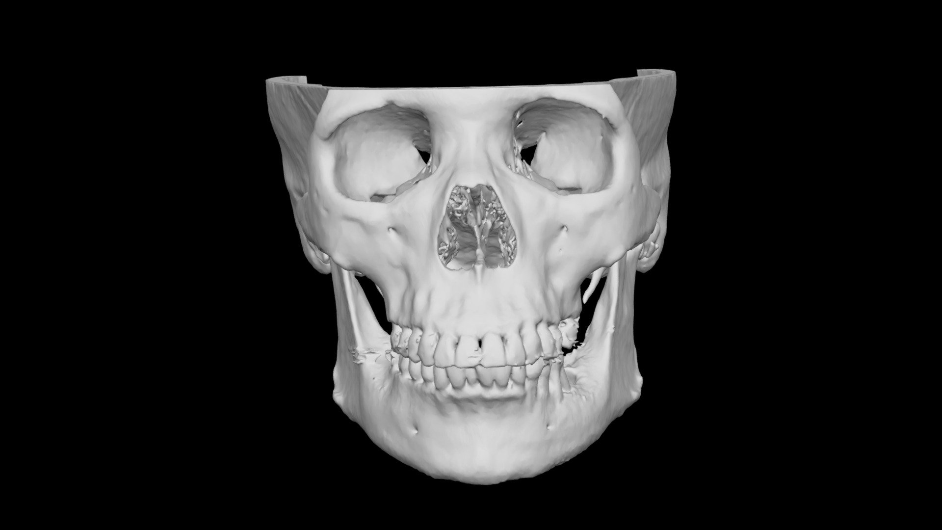 Skull Female 68yo