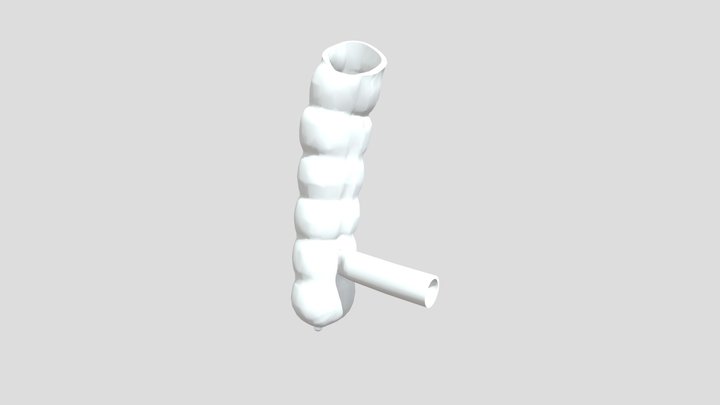 Anastomoz S Vibuhaniyem 3D Model