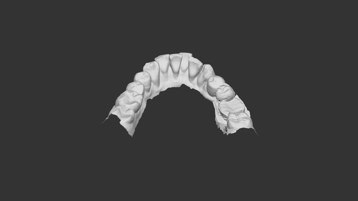 #LabyDent 3D Model