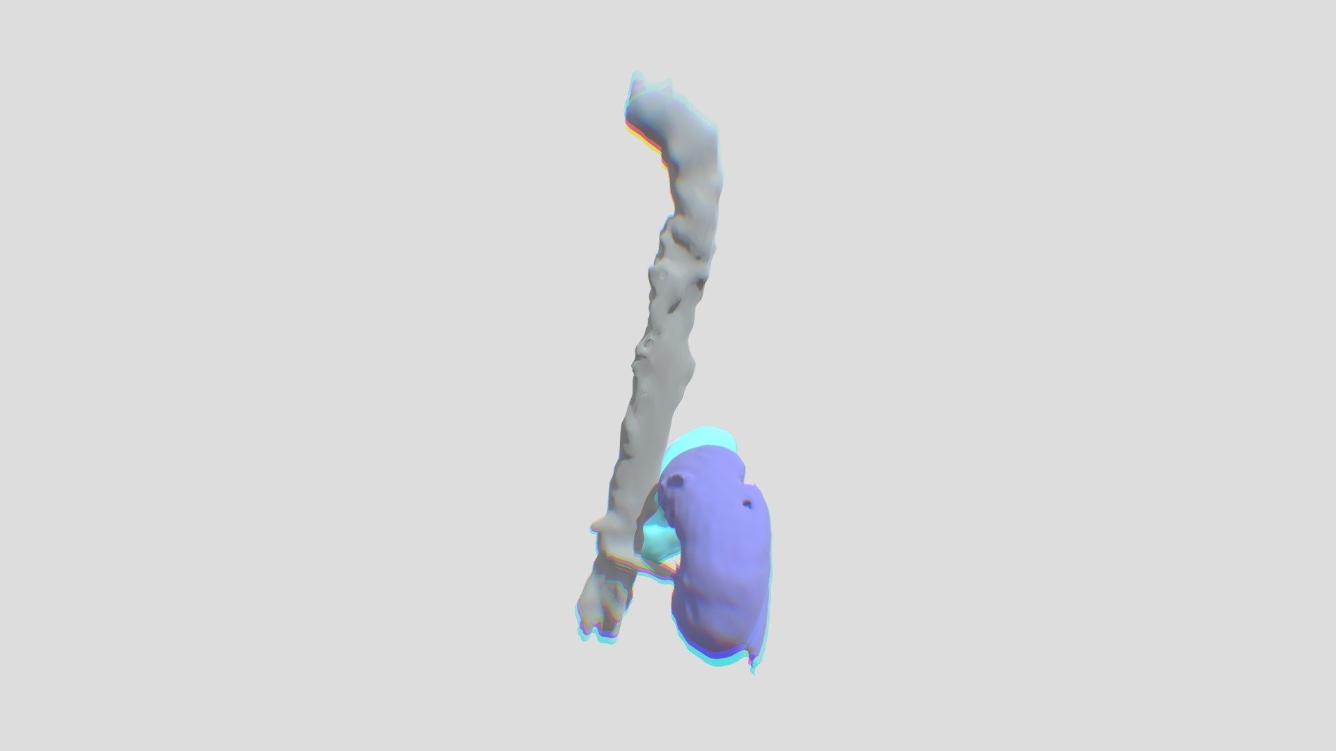 Aortakids