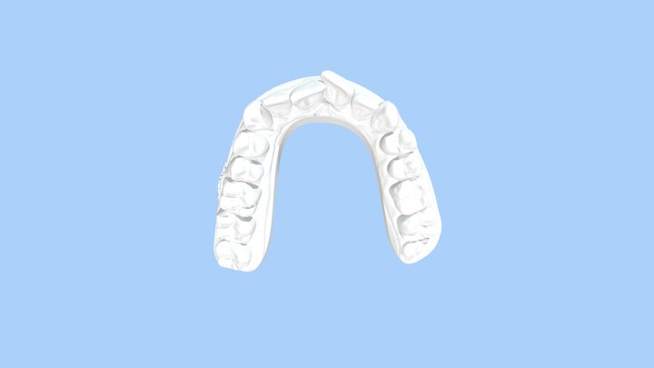 Diego Perez Superior Subsetup1 Maxilar 3D Model