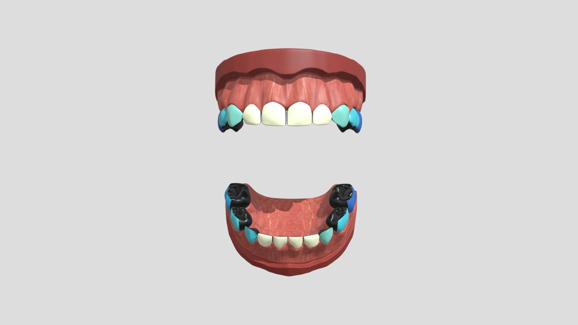 hypo_nzunrestored_4cm_4c