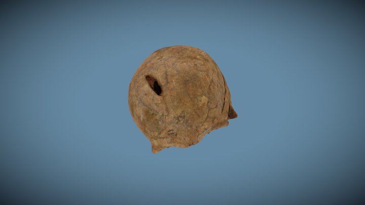SRP9488 Cranium Healed Sharp Force Trauma 3D Model