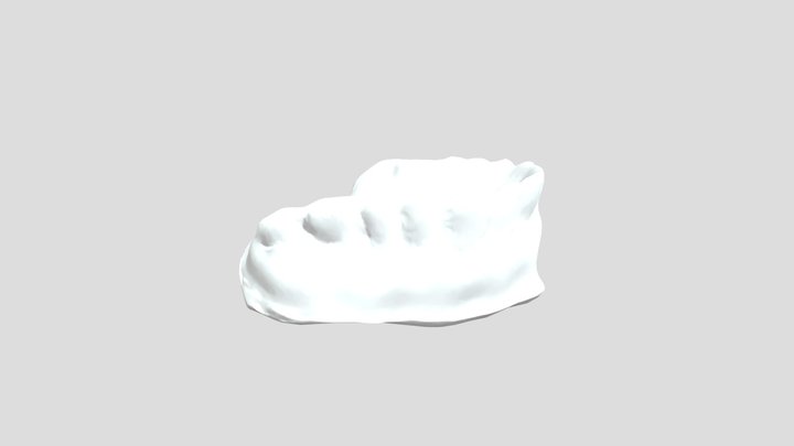 Dentures With Polycam 3D Model