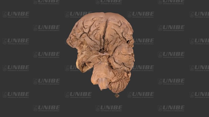 Cerebro 3D Model