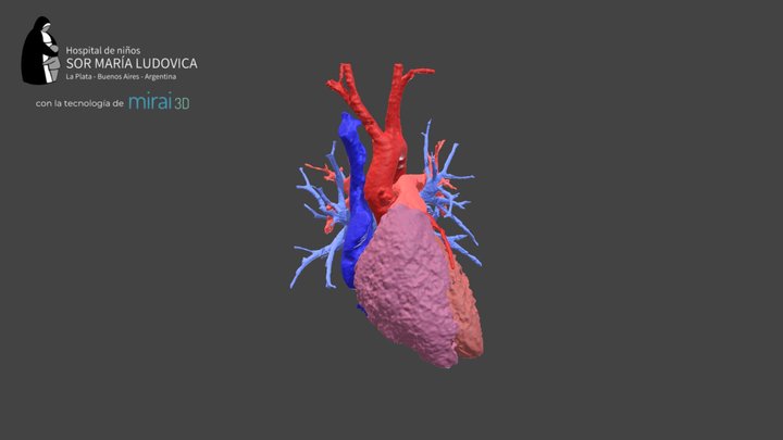 Pool sanguíneo - Corazón sano - Dr. Bleiz 3D Model