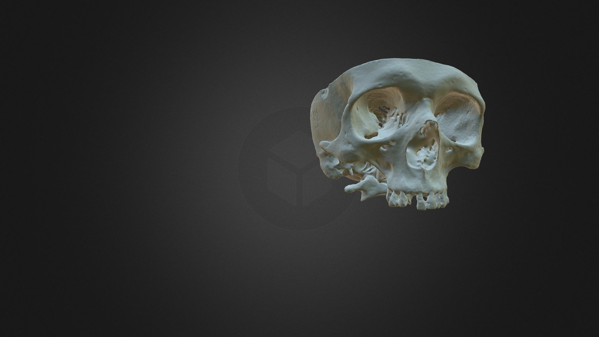 Skull mid portion