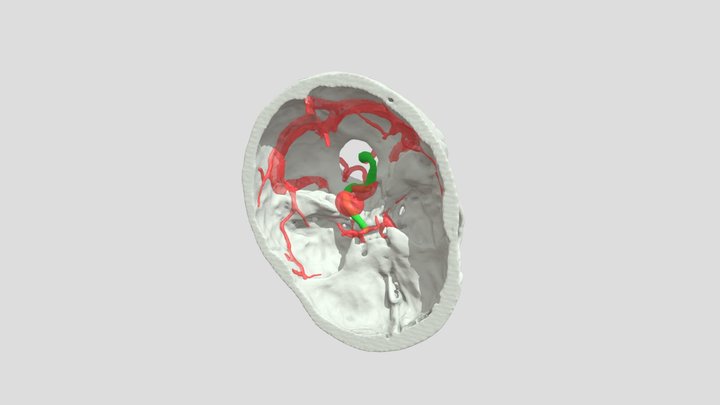 bflow 3D Model