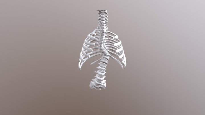 脊椎側彎模型 3D Model