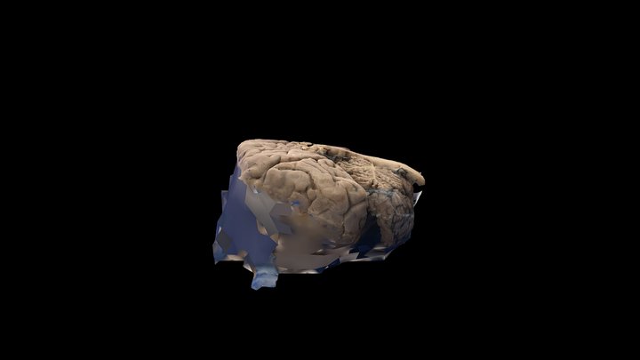 12_02_Hipotálamo_vista_medial 3D Model
