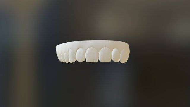Invisalign 3D models - Sketchfab