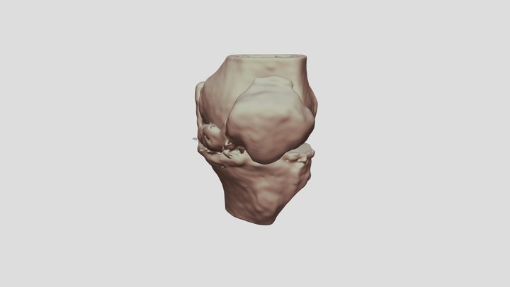 Segmentation_BhPaLtBone1025 3D Model