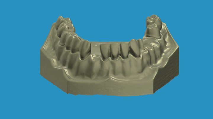 Mandibular arch 3D Model