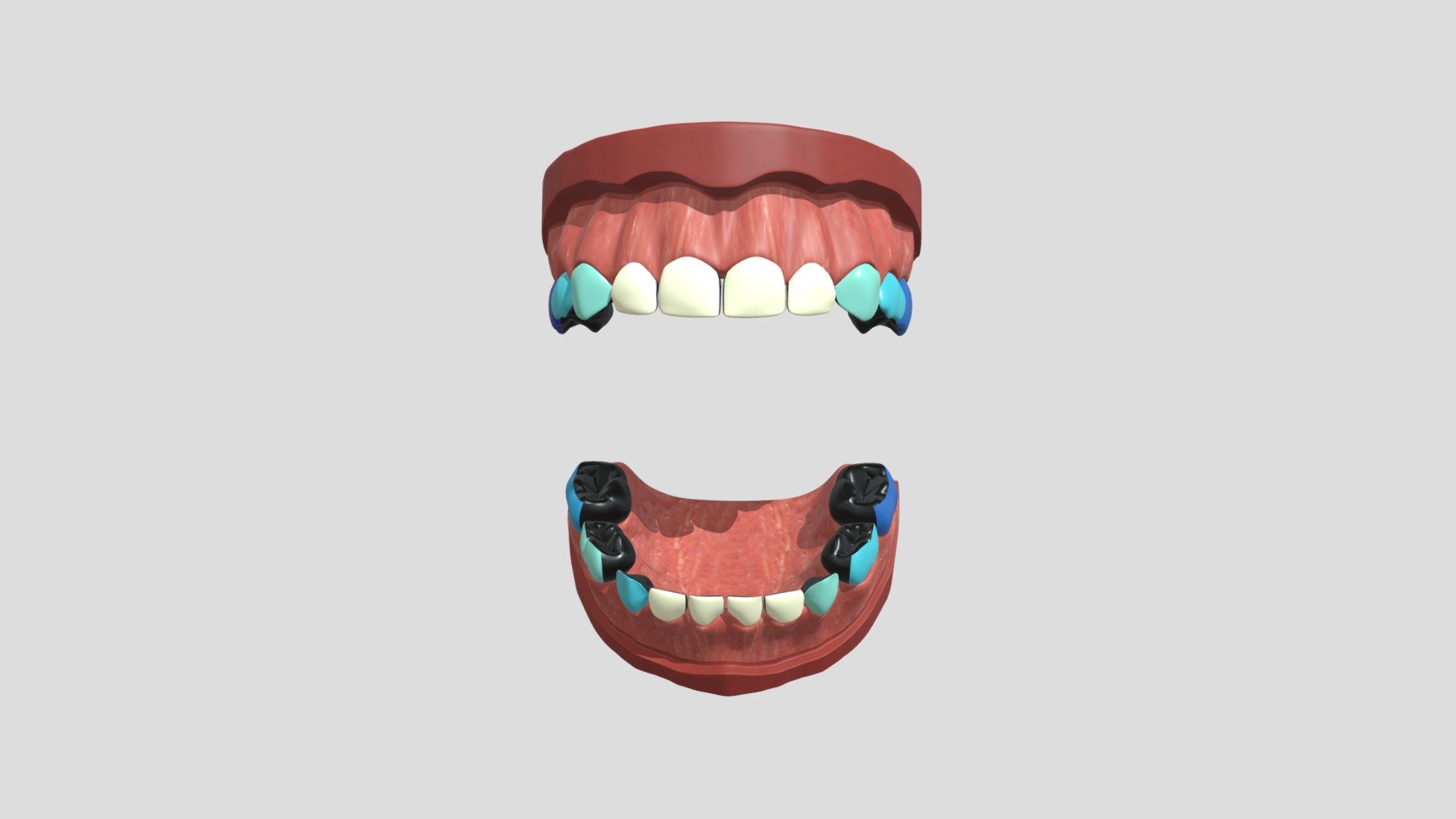 hypo_nzunrestored_3cm_3c