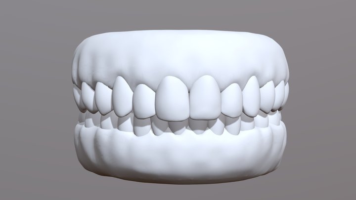 Teeth Movement Crowding Test 3D Model