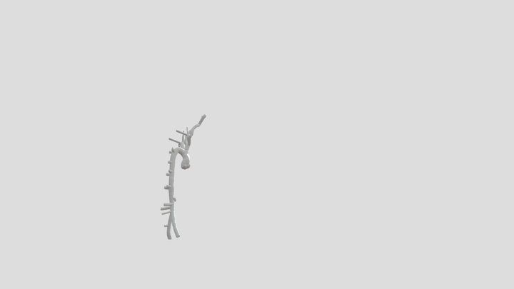 arterisfx pared 08mm, inf 230, sup 315 3D Model