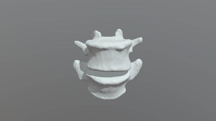 L4/L5 Vertebrae of Lumbar Spine 3D Model