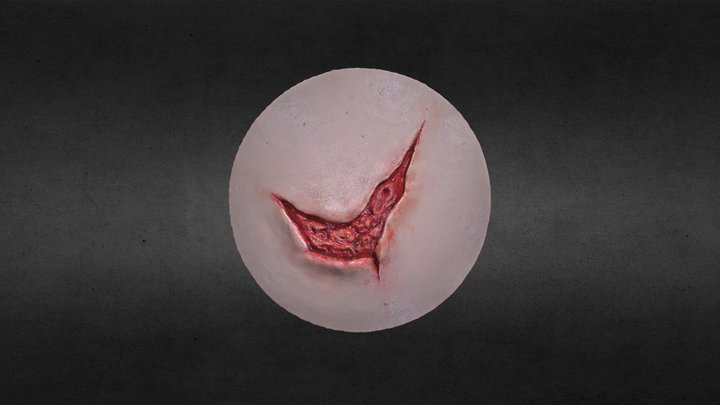 WOUND2 3D Model