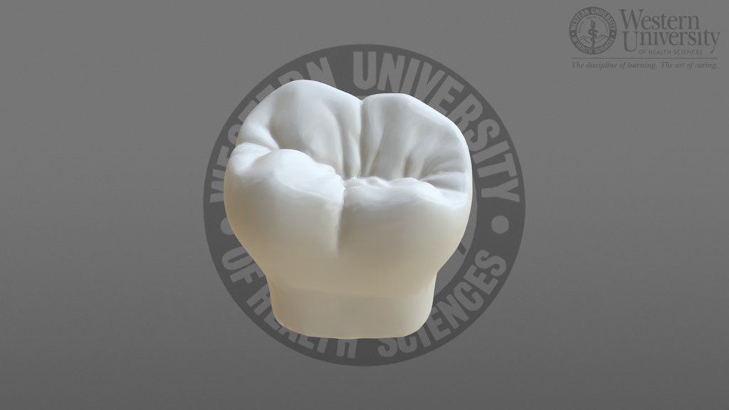 300021 Mandibular 2nd Molar