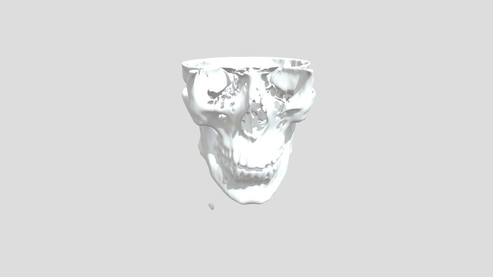 Segmentation_bone 3D Model