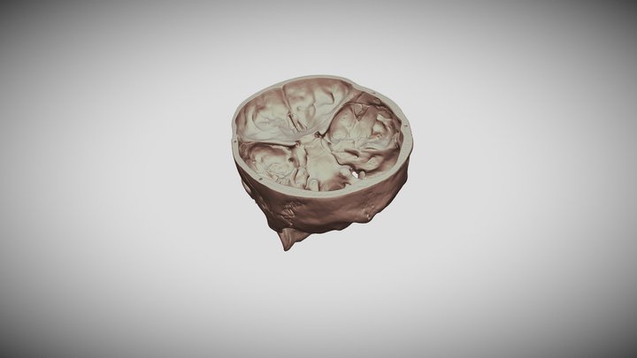 Open Skull 3D Model