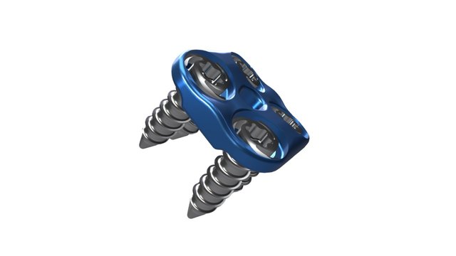 Inset 3D Model
