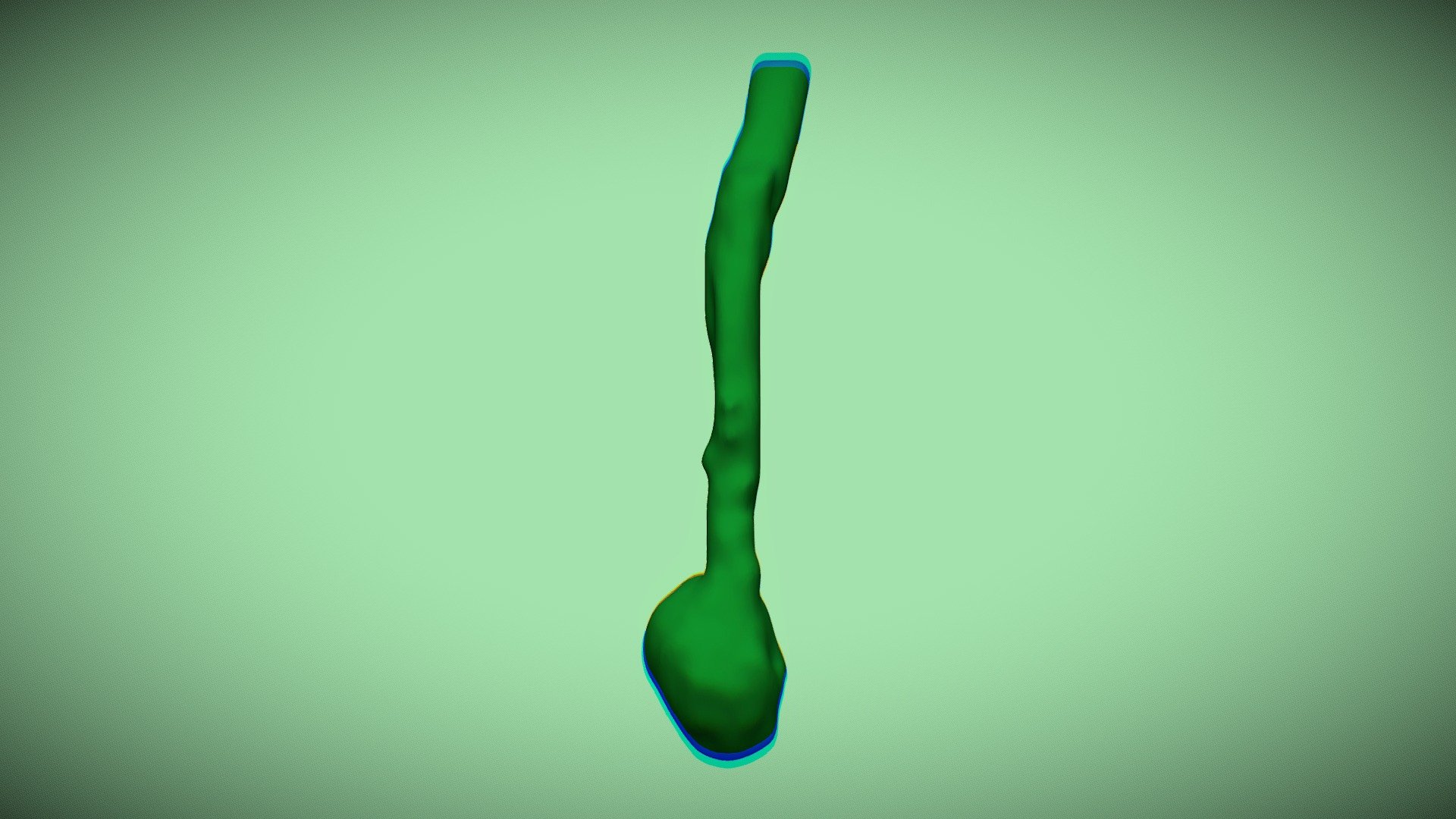 aortic-aneurysm-segmentation-download-free-3d-model-by-khiana-julieth