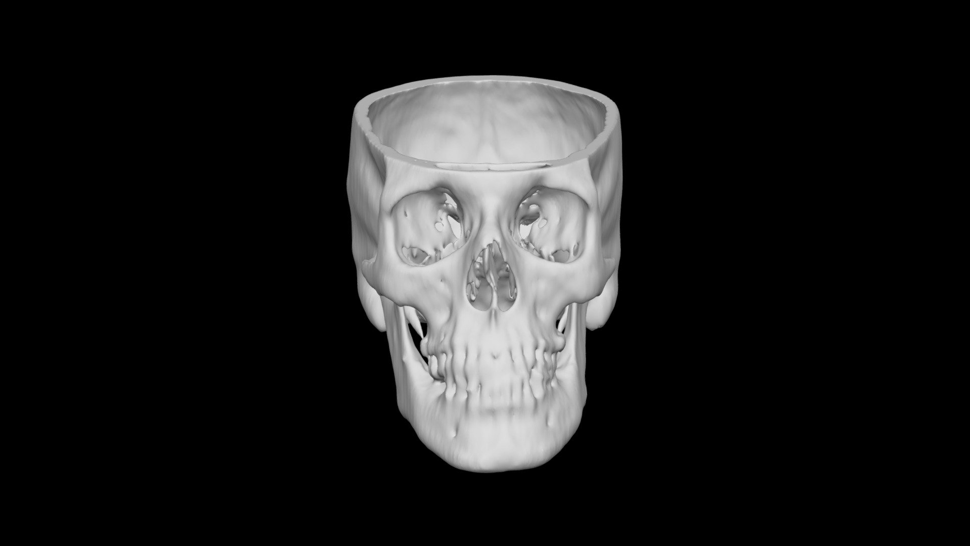 Skull Male 52yo
