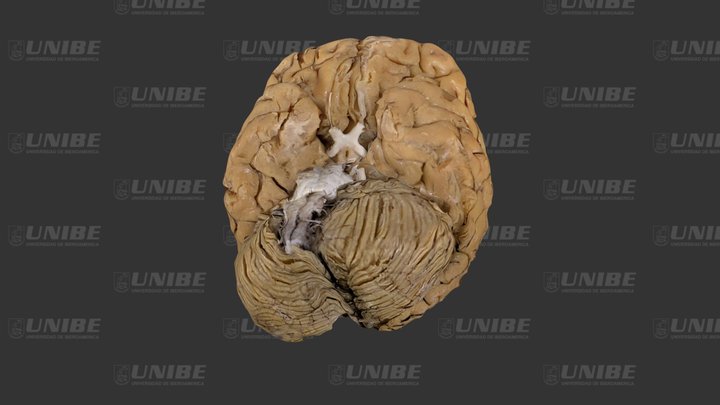 Vista frontal (anterior) 3D Model