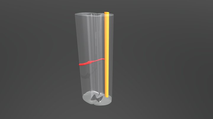 spinothalamic_tract_2 3D Model