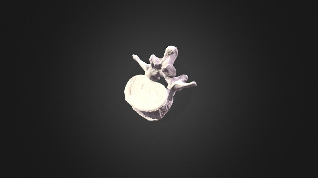 Human Lumbar Vertebra