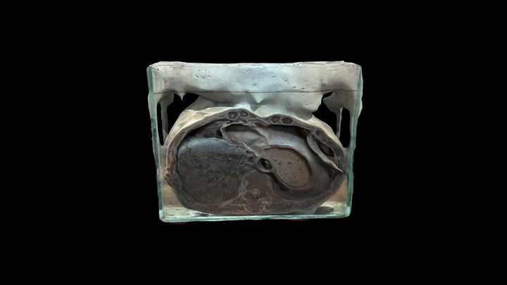 CORTE AXIAL DE TÓRAX: T10-T11 3D Model
