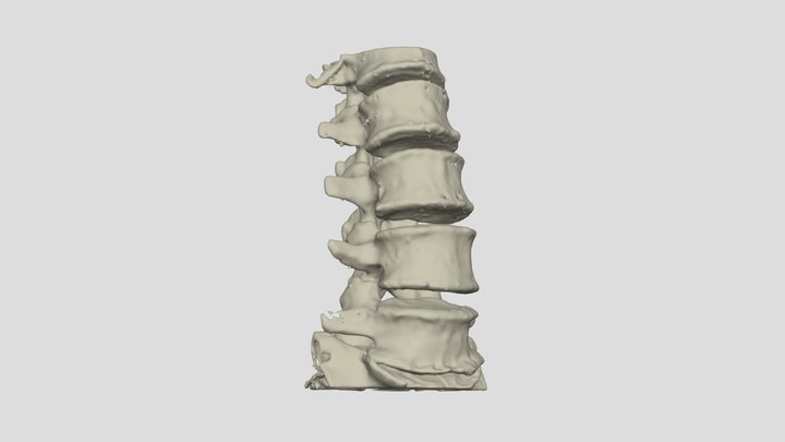 I will convert your ct or mri scans to 3d file 3D Model