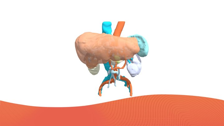 PAT9665AB 3D Model
