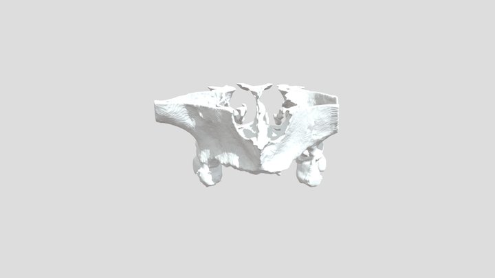Maxila 3D Model