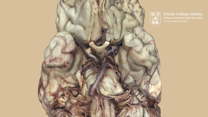 Circle of Willis 3D Model