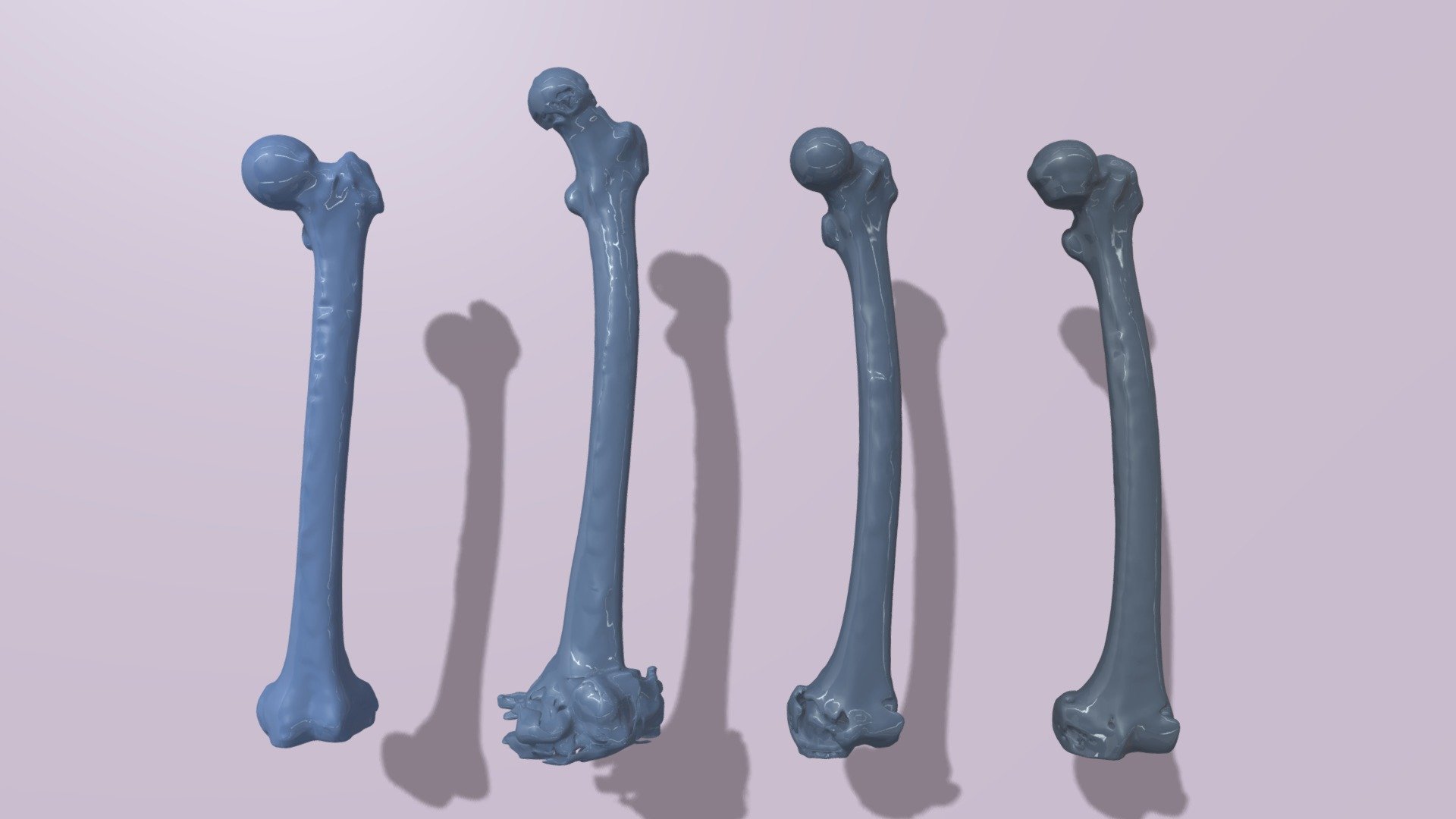 Left Femurs
