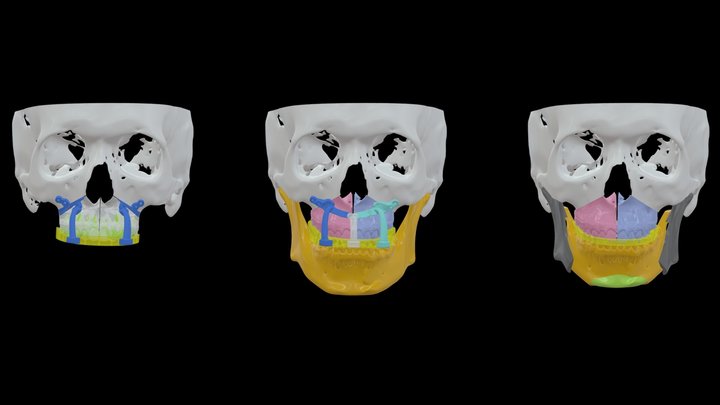 Dr.許-陳O信-0205 3D Model